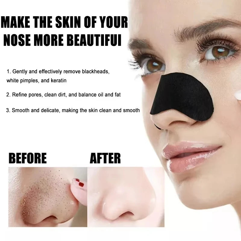 10/50/100 Pieces Facial Blackhead Removal Stickers - Effective Pore And Nose Cleansing Stickers, Gentle Deep Cleansing Care Stic